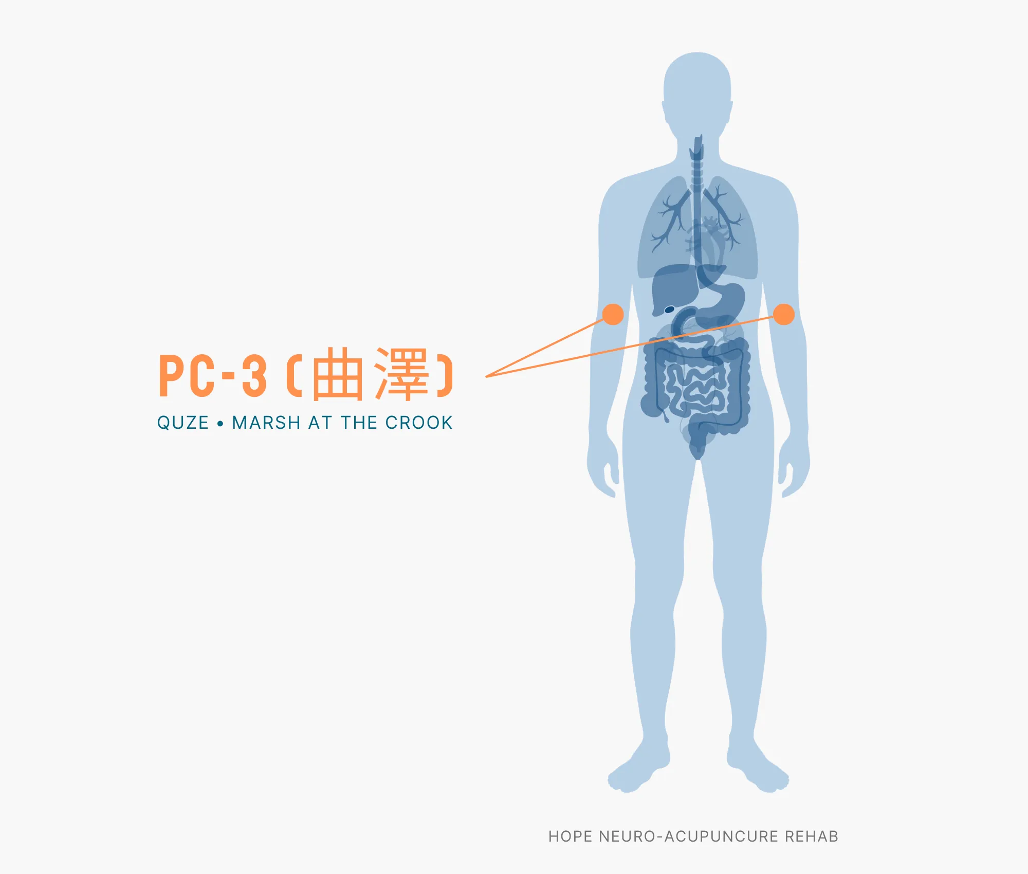 Diagram Showing Where the PC-3 Acupuncture Point (also known as Quze or Marsh at the Crook) is within the Pericardium Meridian