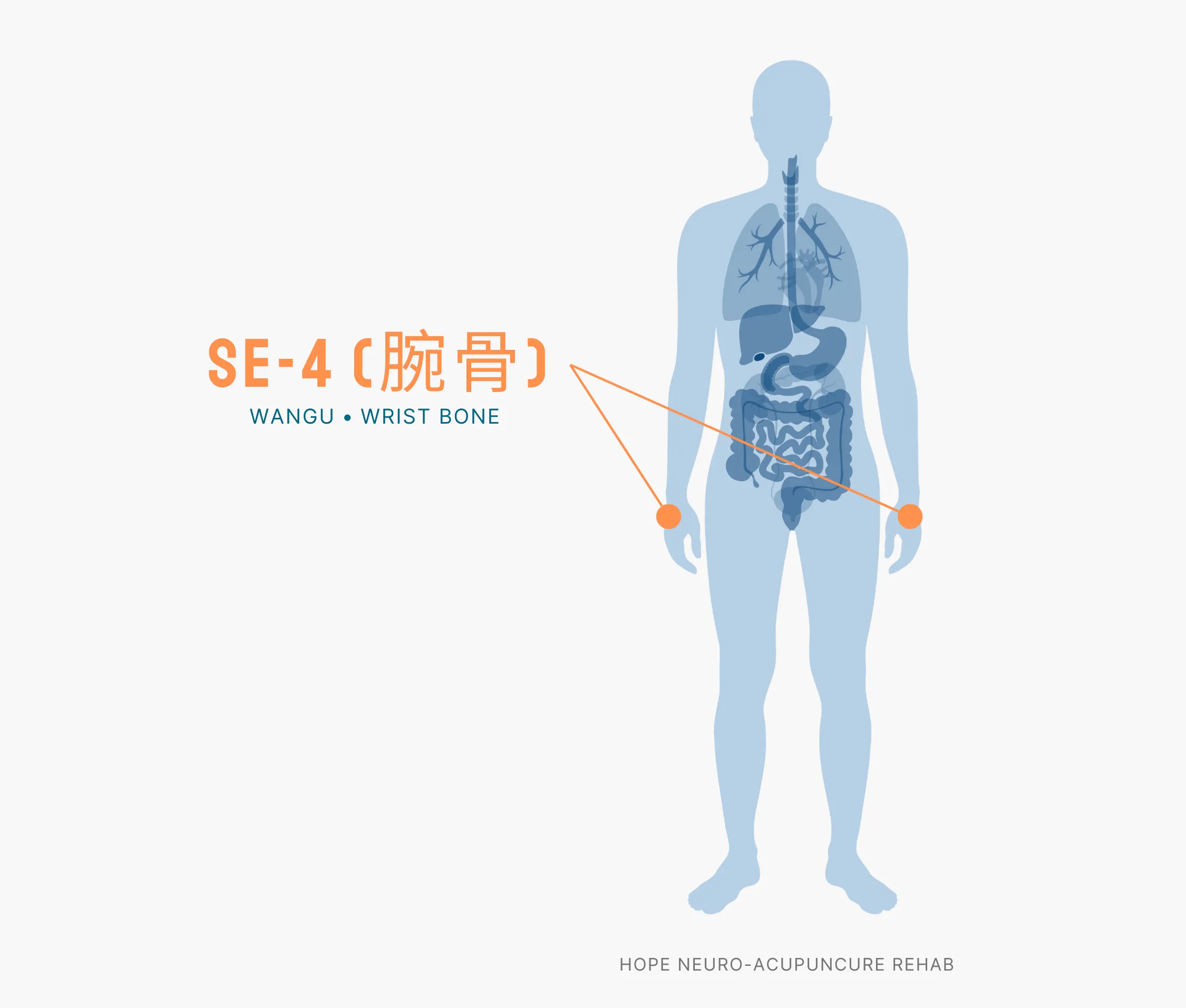 Diagram Showing Where the SI-4 Acupuncture Point (also known as Wangu or Wrist Bone) is within the Small Intestine Meridians