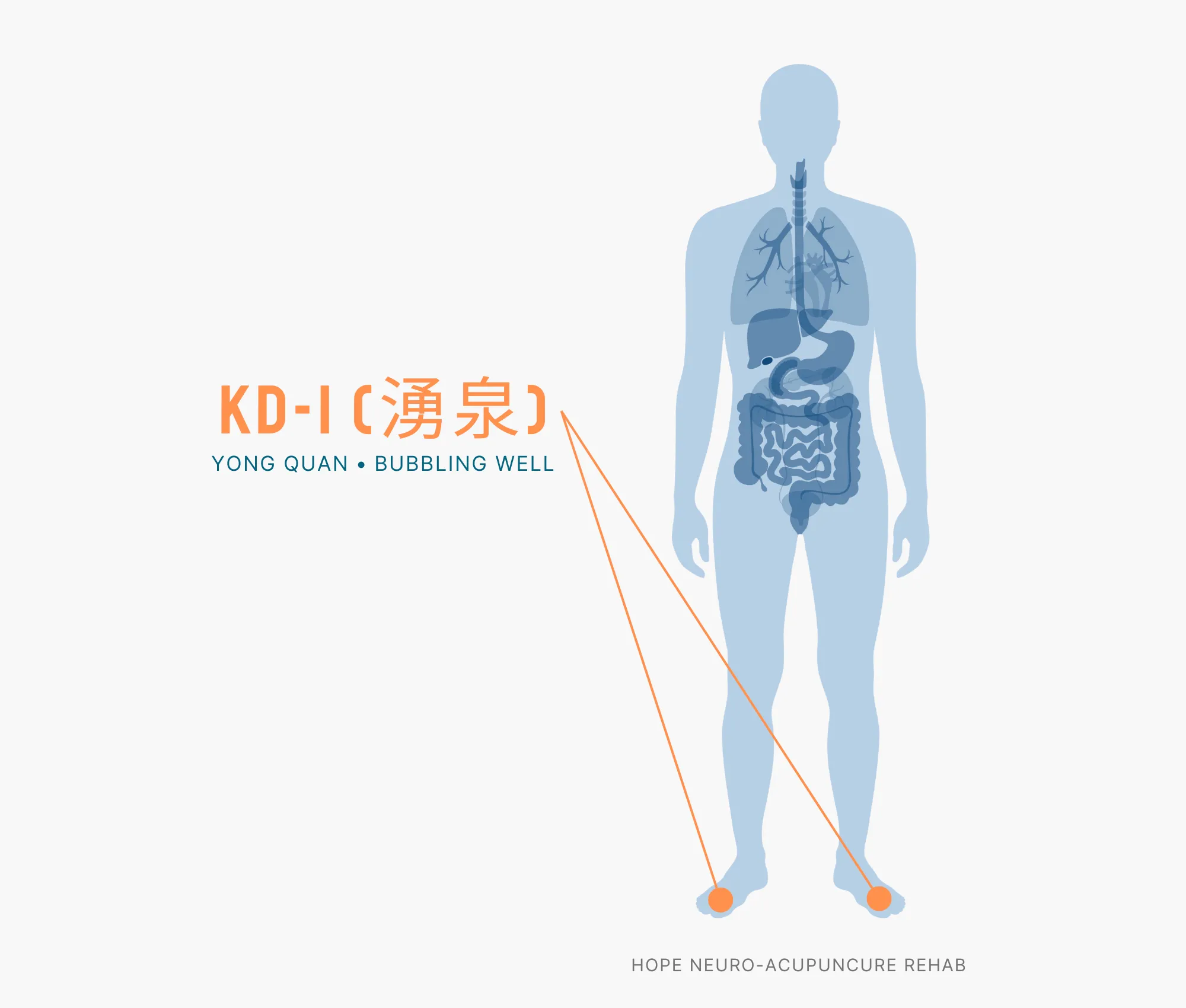Diagram Showing Where the KD-1 Acupuncture Point (also known as Yong Quan or Bubbling Well) is within the Kidney Meridians