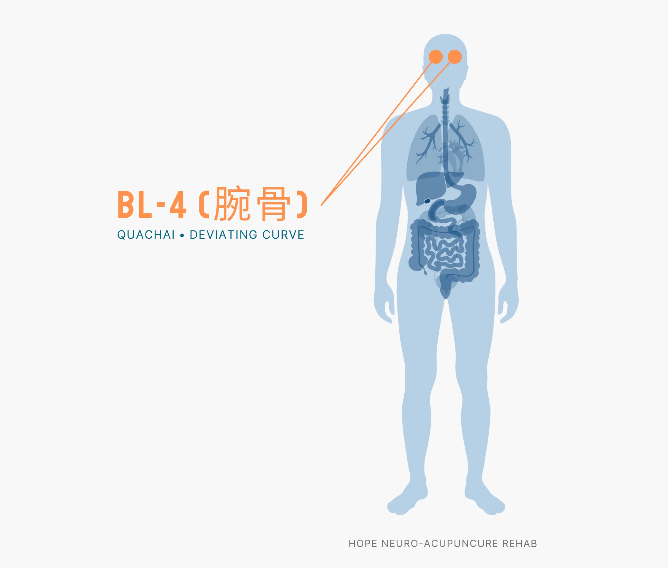 Diagram Showing Where the BL-4 Acupuncture Point (also known as Quachai or Deviating Curve) is within the Bladder Meridians