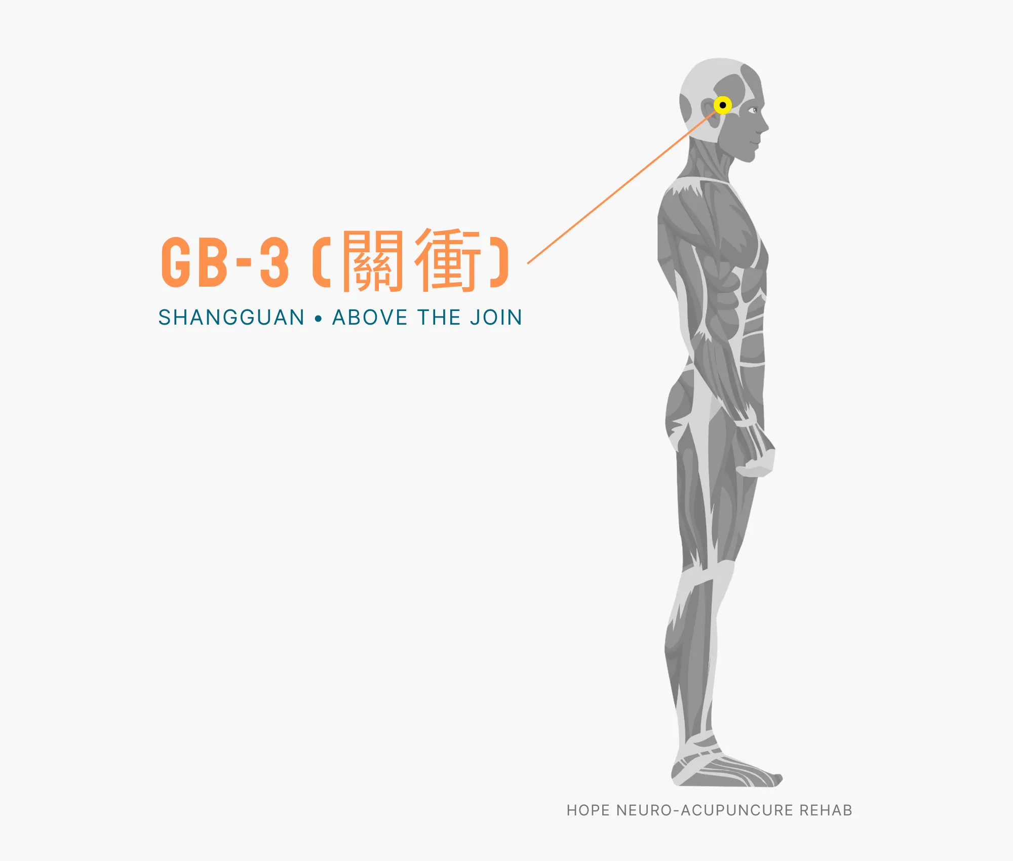 Diagram Showing Where the GB-1 Acupuncture Point (also known as (Tongziliao or Pupil Crevice) is within the Gallbladder Meridian