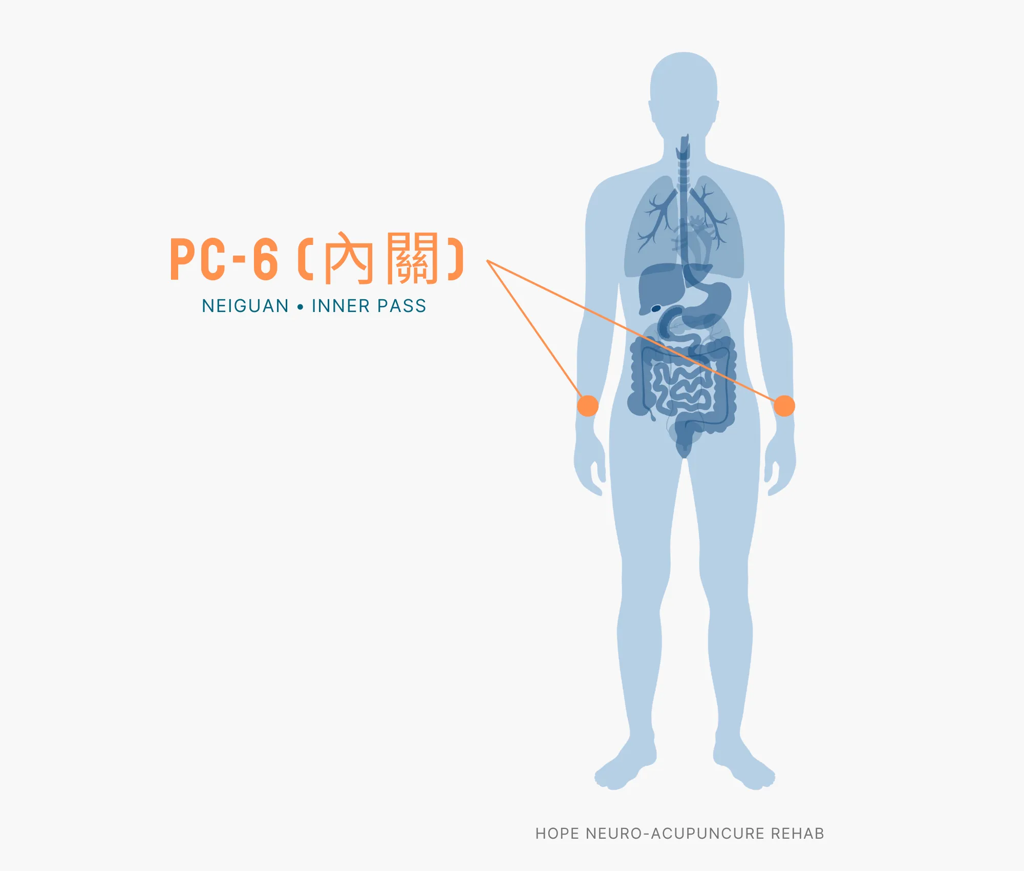 Diagram Showing Where the PC-6 Acupuncture Point (also known as Neiguan or Inner Pass) is within the Pericardium Meridian